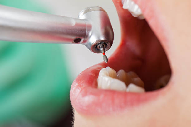 Best Emergency Treatment for Dental Infections or Abscesses in Edgeworth, PA